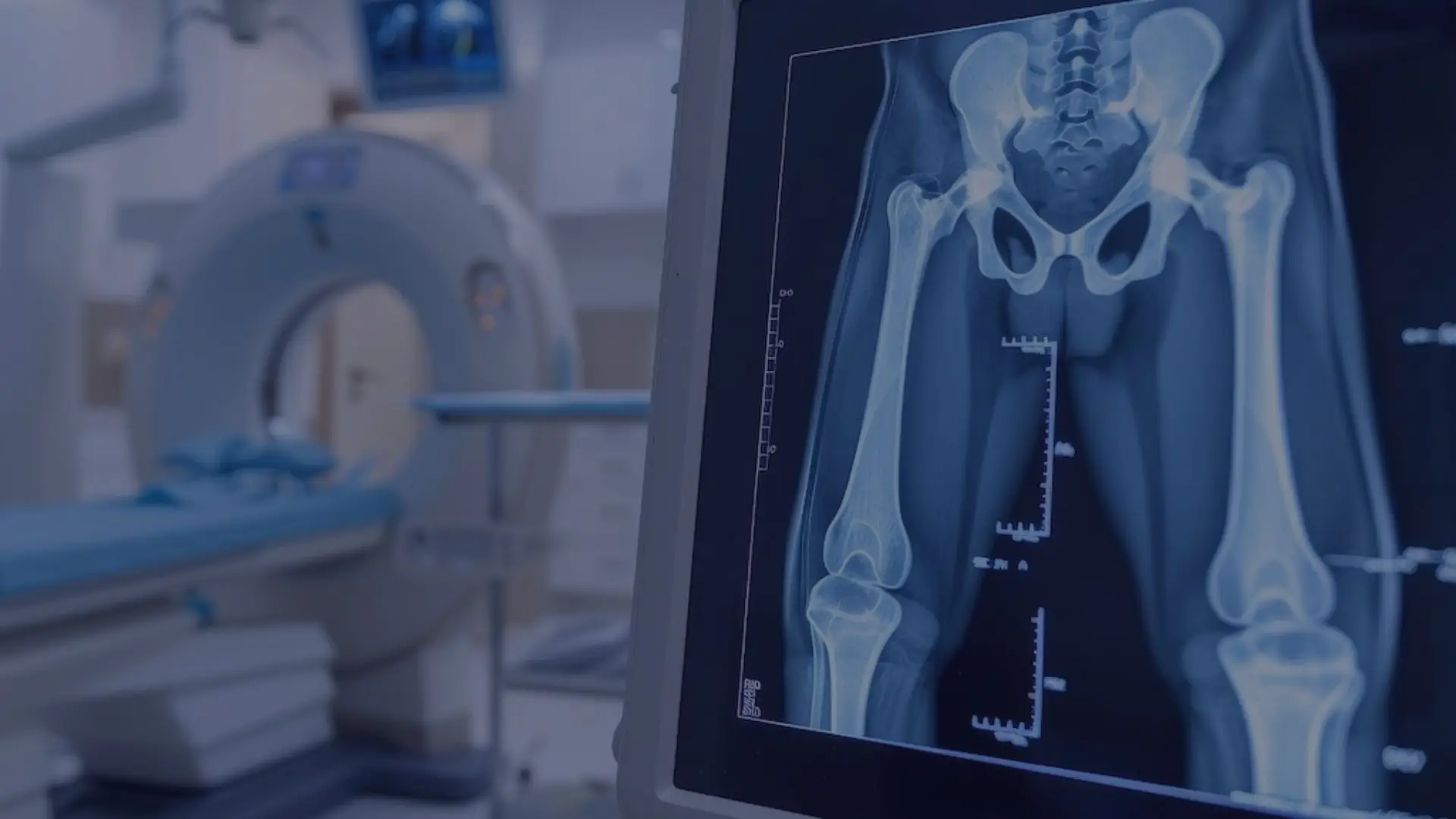 Innovation Is Redefining Orthopedic Devices, But Is Your Talent Strategy Keeping Up?