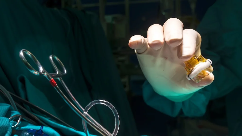How Emerging Valve Technologies Are Reshaping Cardiology Device Sales