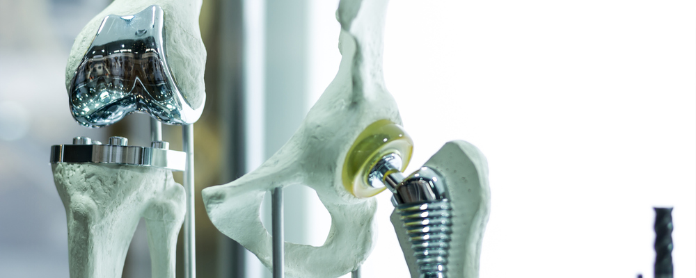 The Growing Need For Expertise In Patient Specific Implants (PSI) In Orthopaedics