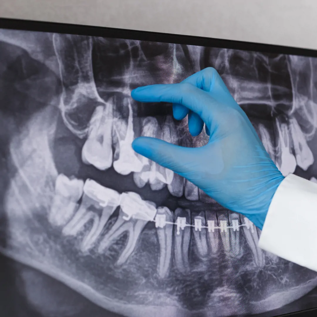 Dental Technician at work